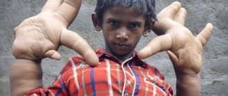 Заболевание у мальчика