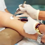 Забор крови из вены