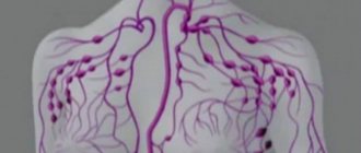 areas affected by lymphoma